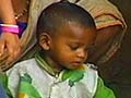 Pune transport head apologises for using money for malnourished children to run buses