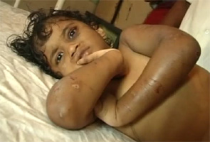 Mother used hot iron rods, blade to ‘Discipline’ child