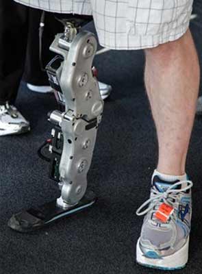 chicago_bionic_leg_103_floors_amputee_295.jpg