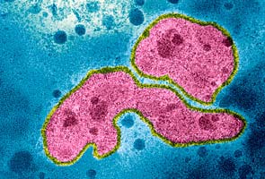New SARS-like virus detected in Middle East 