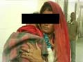 Bikaner baby who was bitten by her father on nose, lips dies in hospital