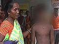Class VIII student tortured with blades, sticks