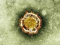 Panic grips Saudis amid fears of SARS-like virus
