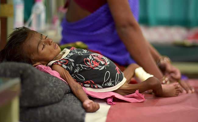 About 160 million children under age five suffer from chronic malnutrition worldwide, the study revealed.