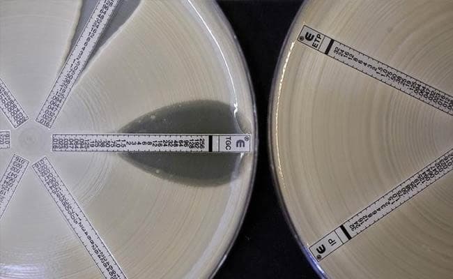Two plates which were coated with an antibiotic-resistant bacteria called Klebsiella with a mutation called NDM 1 and then exposed to various antibiotics are seen at the Health Protection Agency. (Reuters)