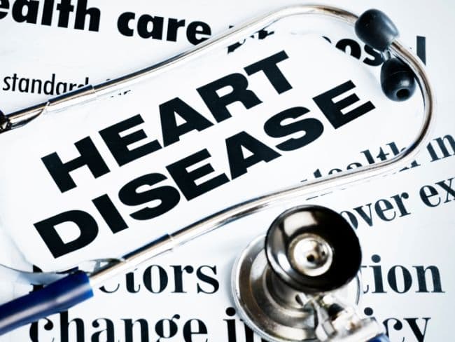 Approximately 37 million people are living with HIV, according to the World Health Organization. (Representational image)