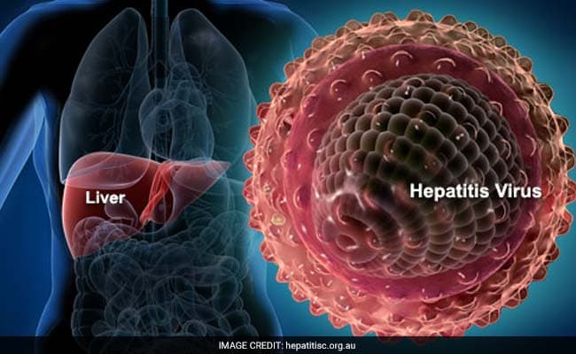 The deadly Hepatitis C virus afflicts as many as 150 million people worldwide and possibly 12 million in India. (Representational Photo)