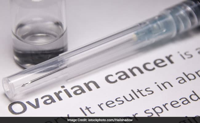 A natural compound isolated from onions may help treat the most common type of ovarian cancer.