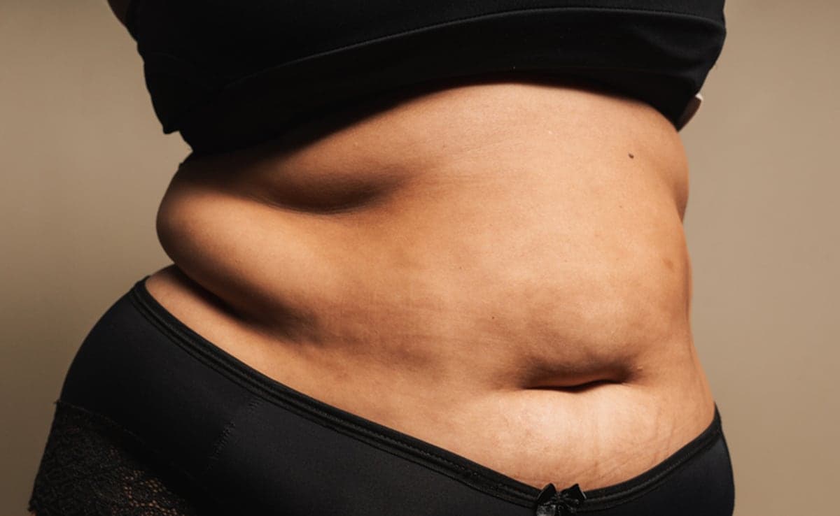 Women's Health: Avoid These Foods During Menopause To Manage Excess Belly Fat