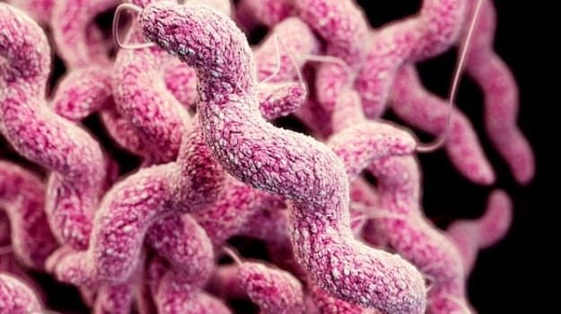 DNA sequencing will look for mutations in minimum 77 genes that are associated with medical conditions