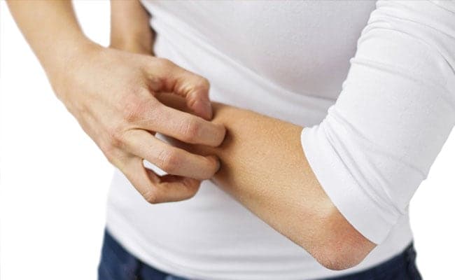 Symptoms of allergies can range from from minor irritations to anaphylaxis