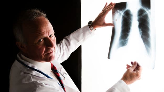 Lung Cancer Day: Early stage lung cancer, if treated diligently, has survival rate of more than 5 years