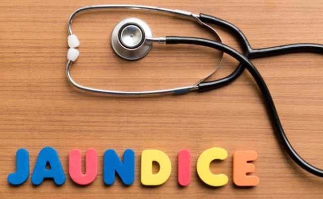 Jaundice: Some Causes and Symptoms You Must Know