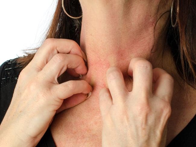 Chickenpox usually happens to children between 5 to 10 years of age