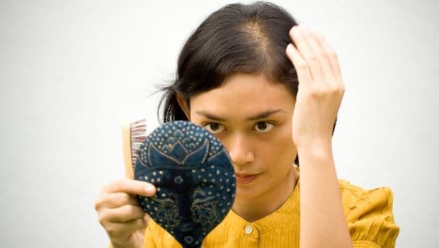 Post-pregnancy hair loss can be dealth with by consuming a balanced diet