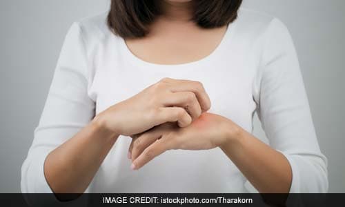 Leprosy: Know The Symptoms And Risk Factors Of This Condition