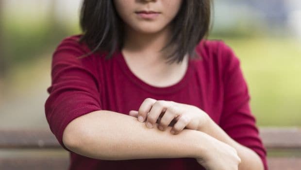 Psoriasis Vs Eczema: Here's How You Can Spot The Difference