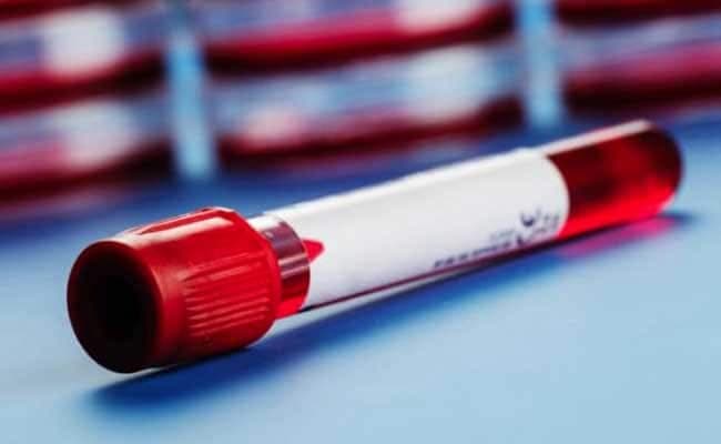 The minimum prescribed level for blood donation is 12.5 g/dL.