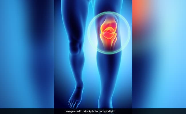 Osteoarthritis: 7 Best Foods