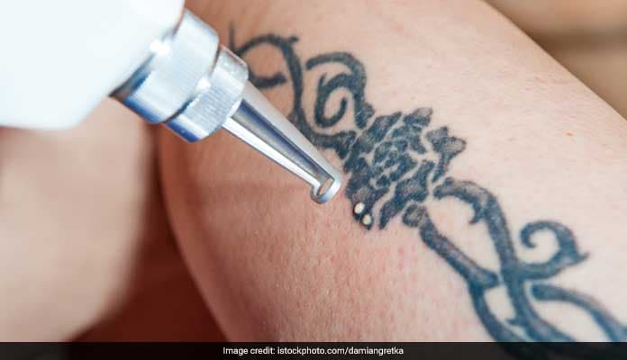 Tattoos can severely affect your skin and cause diseases as serious AIDS