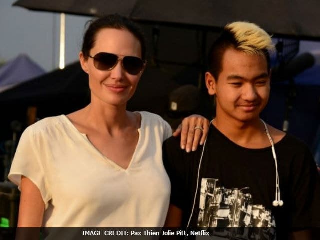 Anjelina Jolie: Bell's palsy fact sheet