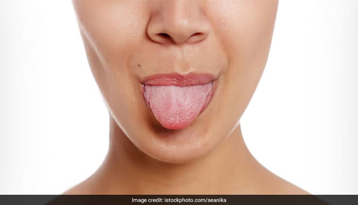 Know the power of your tongue