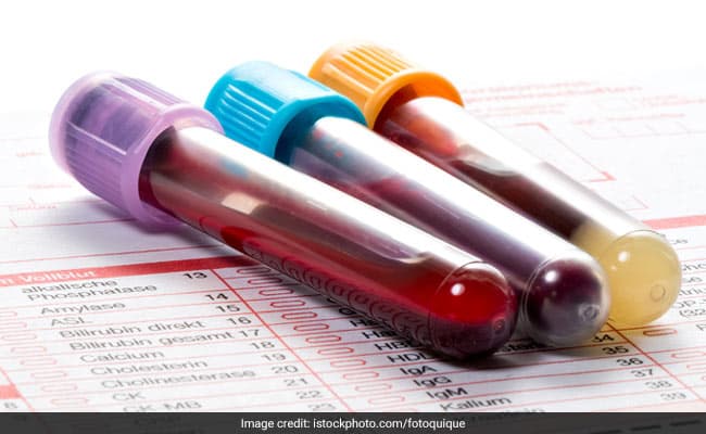 World Thalassemia day: Thalassemia shows very mild symptoms