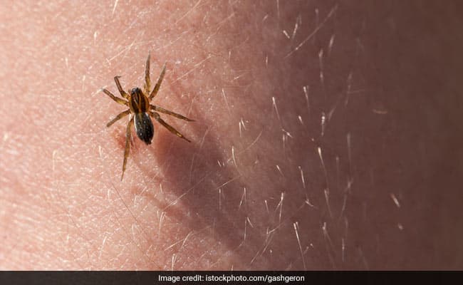 Here's how you can deal with a spider bite