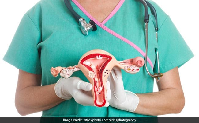 Cervical Cancer The Journey Of A Preventable Cancer