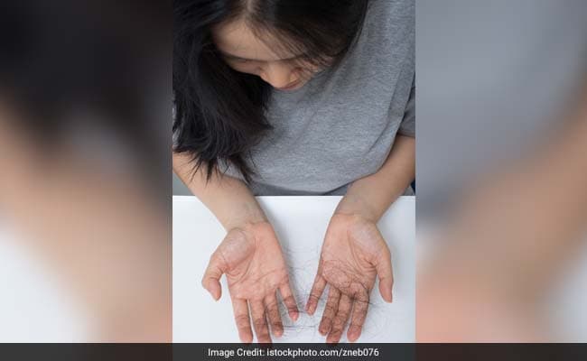 Onion juice provides your hair with extra sulphur to induce better growth