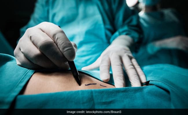 Separations and divorces are slightly more common after bariatric surgery