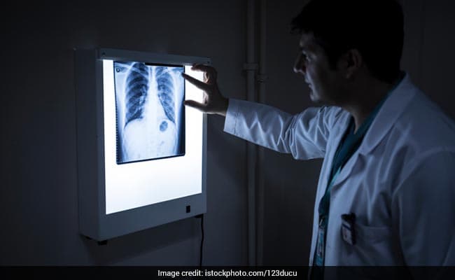 Doctors are the local hospital had initially failed to diagnose the bulb