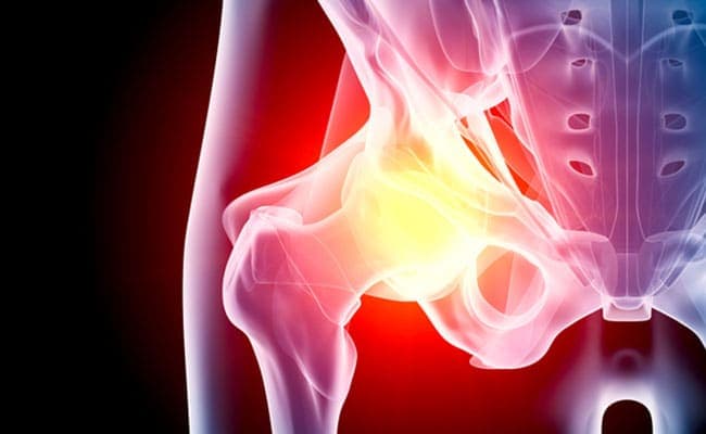 Groin strain and groin pull are the most common injuries in athletes