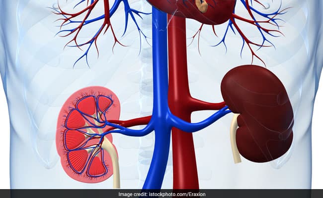 For a healthy life one must have well functioning kidneys