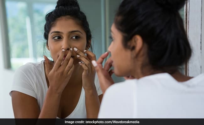 Acne treatment: Avoid dairy to prevent and reduce acne