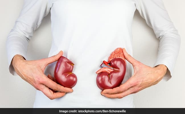 Dialysis is done on the kidney to remove toxins from the body