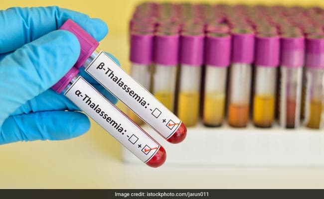 International Thalassemia Day is observed on 8th May each year