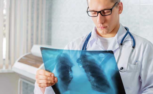 Soluble child-sized doses of the three major drugs used to treat TB will be available, helping to save lives. (Representational Image)