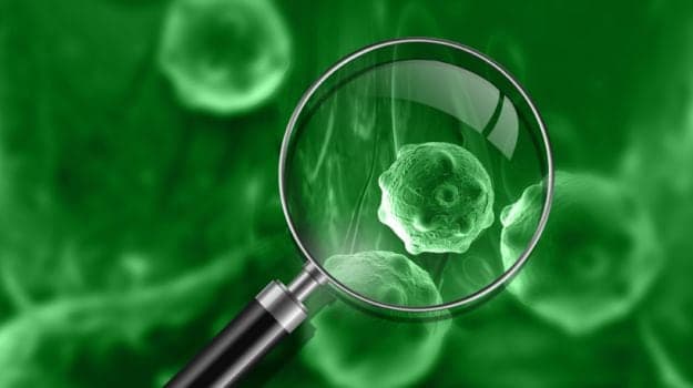 Regular testing for ovarian cancer could reduce deaths from this silent killer of women by a fifth. (Representational Image)