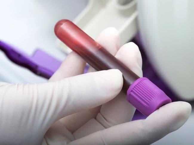 The technique would save a liver transplant patient in India from having to undergo unwanted blood transfusion.