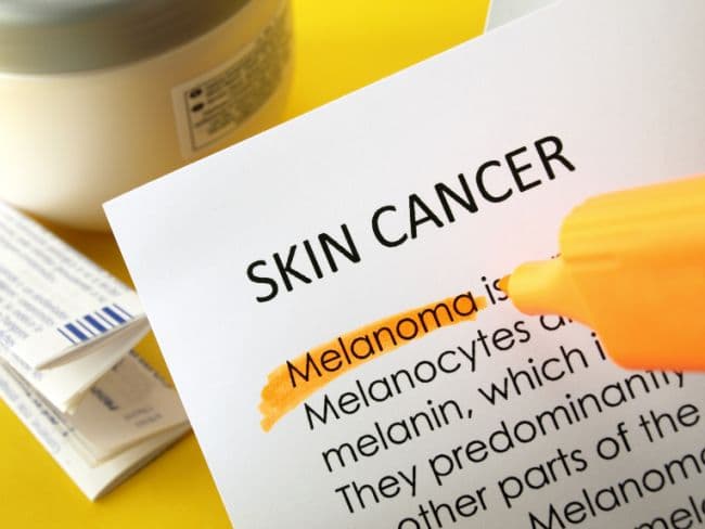 The age-induced loss of beta-catenin renders melanoma cells less capable of dealing with reactive oxygen species. (Representational Image)