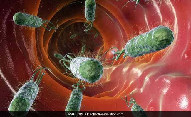 The presence of these bacteria may lead to new ways to diagnose patients. (Representational Image)