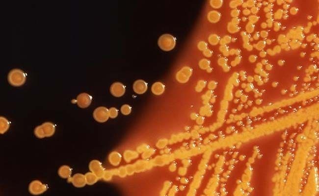 There is no easy answer to the problem of antimicrobial resistance. (Representational)