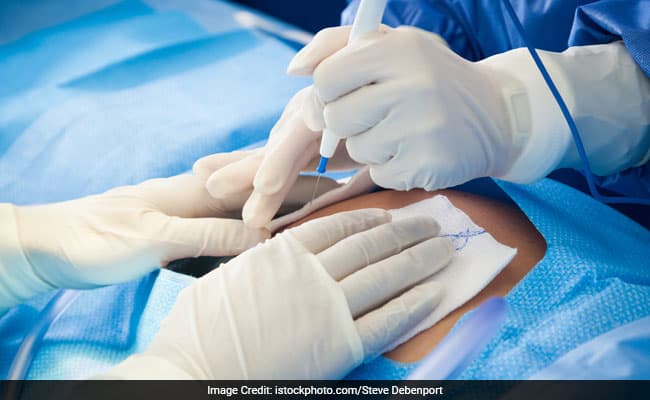 Women are four times more likely to suffer from blood clots after a cesarean-section delivery.