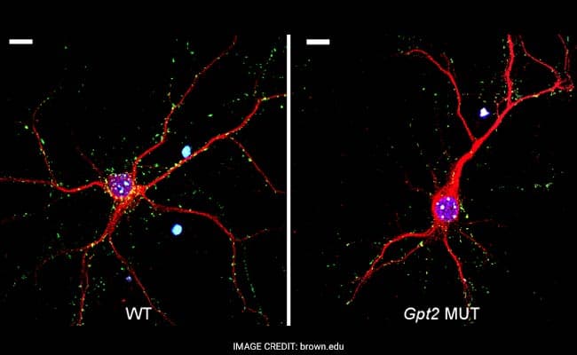 Mouse neuron on the left has more synapses than the one with a mutation in the gene GPT2.