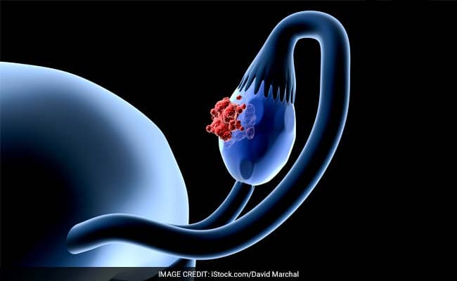 Researchers tested levels of circulating tumour DNA in patients before and after treatment