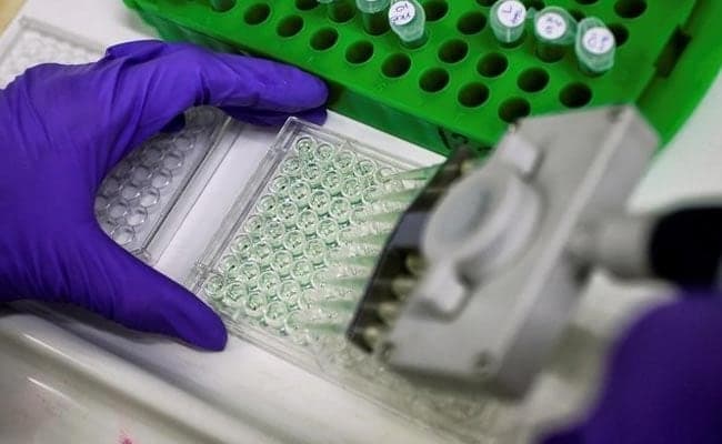 A scientist prepares protein samples for analysis in a lab at Institute of Cancer Research in Sutton.