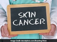 Skin Cancer is treatable if detected early.