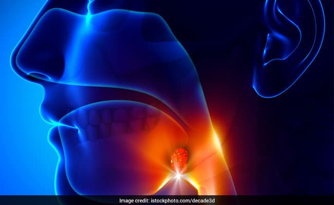Health Coach Luke Tells Why You Need Think Twice Before Tonsil Removal; Tonsillectomy Do's And Don't