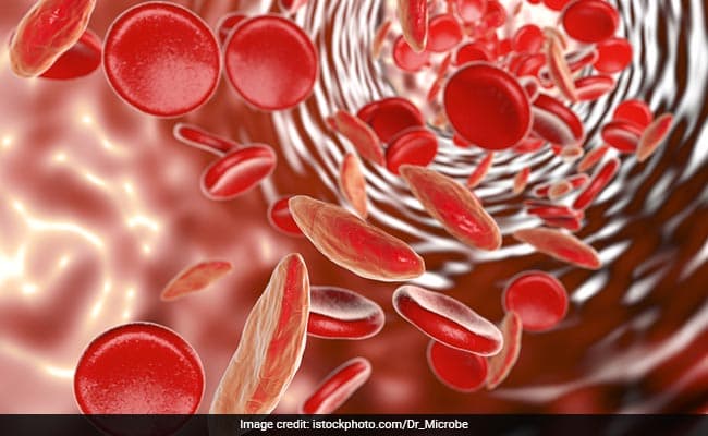 World Cancer Day 2021: Know The Symptoms And Risk Factors Of Leukemia